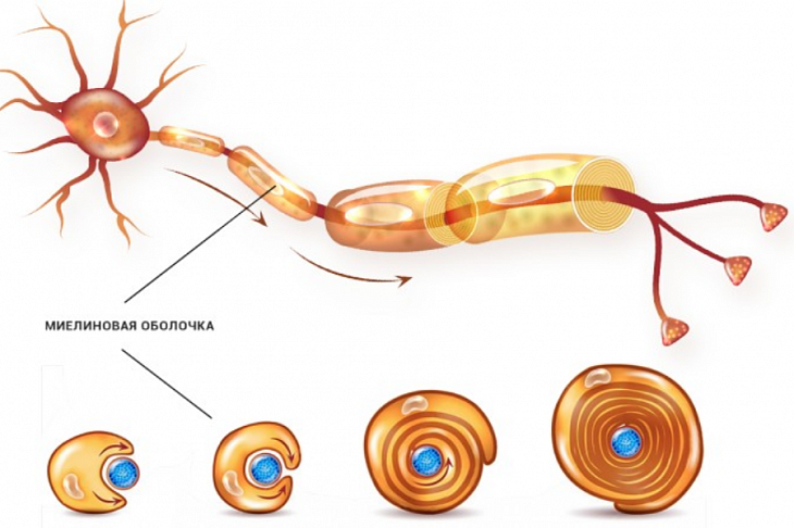 Новое открытие позволит вылечить рассеянный склероз