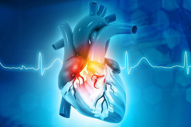 Российские медики совершили настоящую революцию в кардиологии