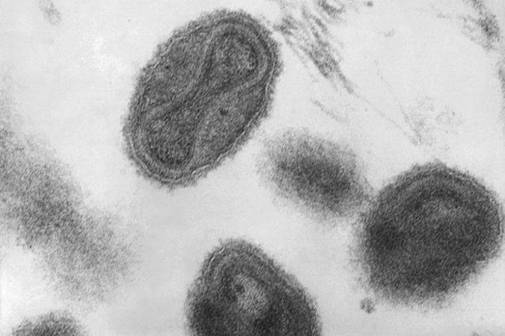 Россия начинает испытания первого отечественного средства против оспы