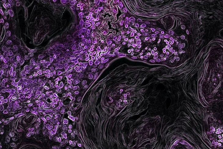 Раскрыт новый эффективный способ лечить рак