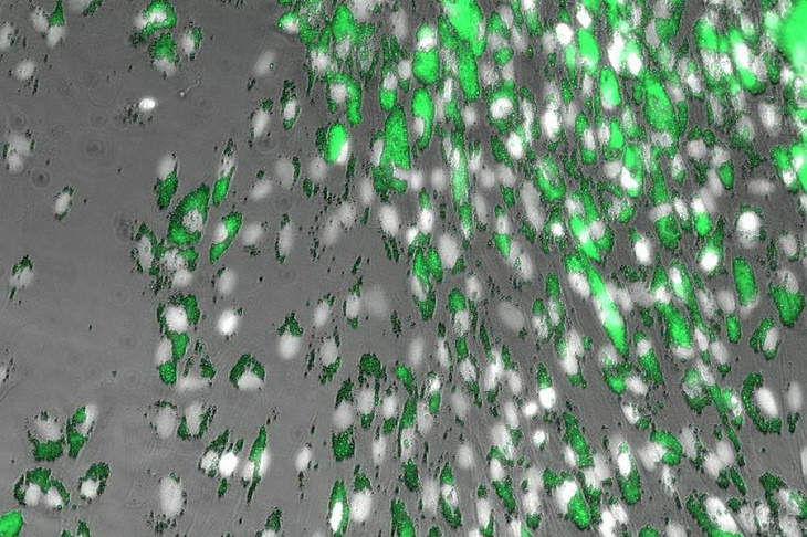 Микро- и наночастицы пластика нашли в человеческих тканях