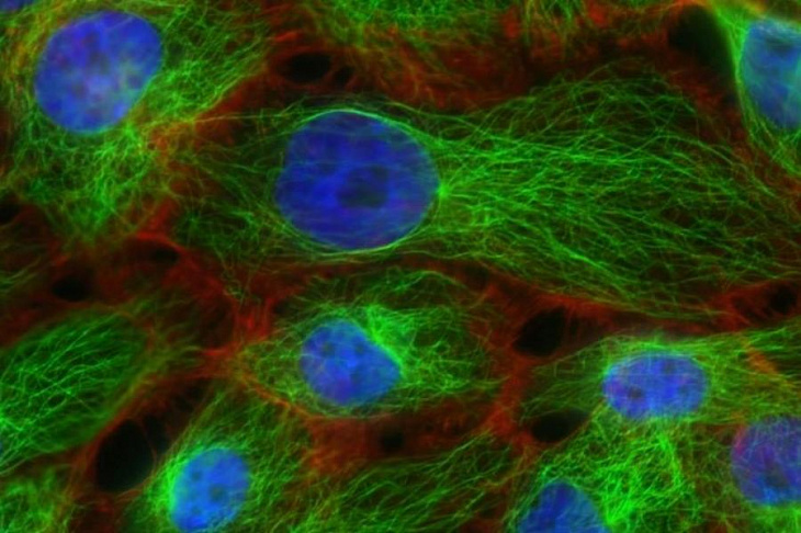 Как иммигрантка из Ирана совершает революцию в лечении рака
