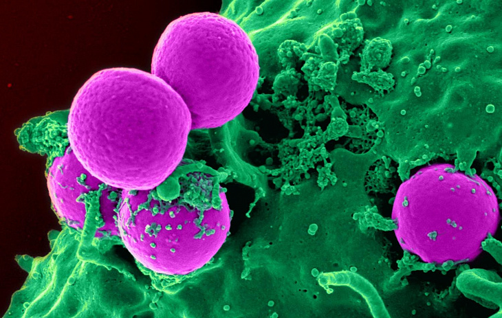 Стволовые клетки полностью восстановили мозг крыс после инсульта