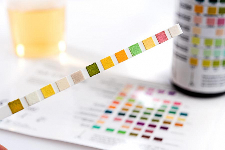 Российских старшеклассников начнут массово проверять на наркотики