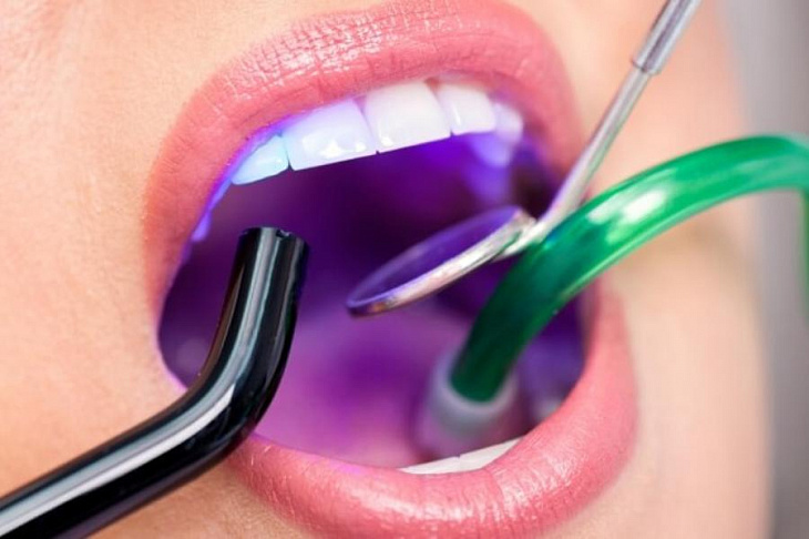 Стоматолог: в каких случаях нужно менять пломбу