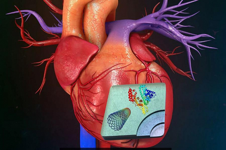 В России придумали, как вылечить инфаркт миокарда за считанные месяцы