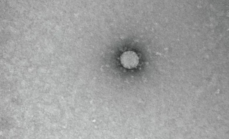 Установлена температура гибели коронавируса