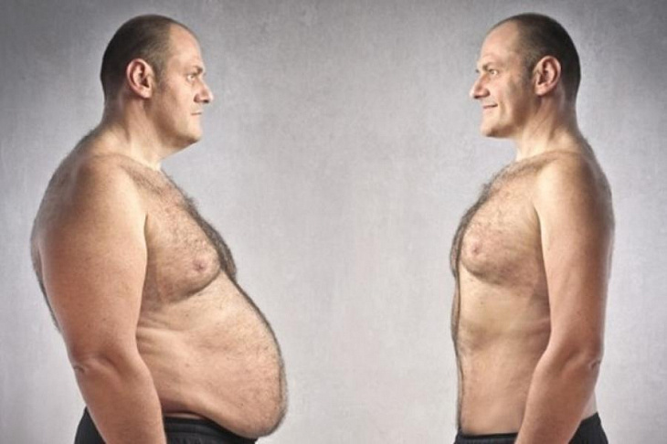 Три основных причины развития ожирения и почему это так опасно