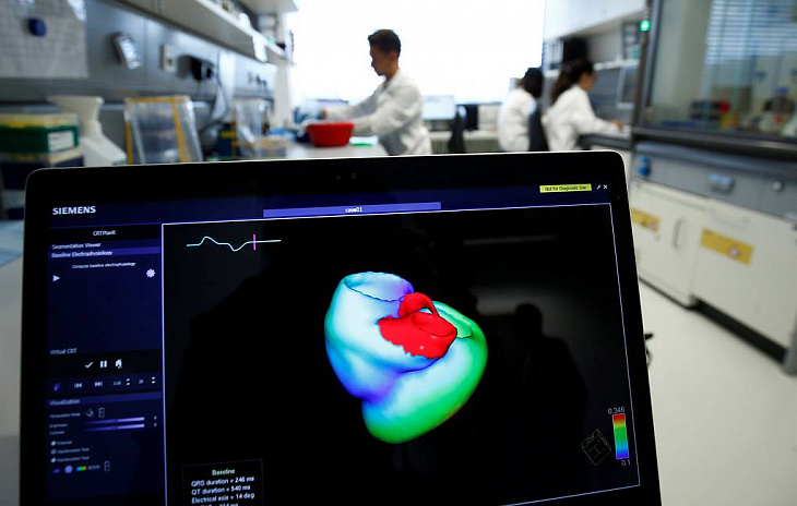 МРТ показала новые различия в работе сердца мужчин и женщин