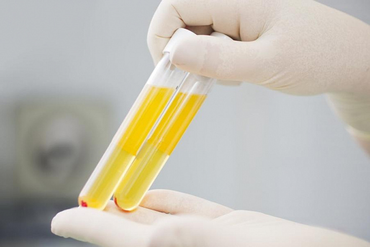 Вирусологи открыли уникальные свойства плазмы