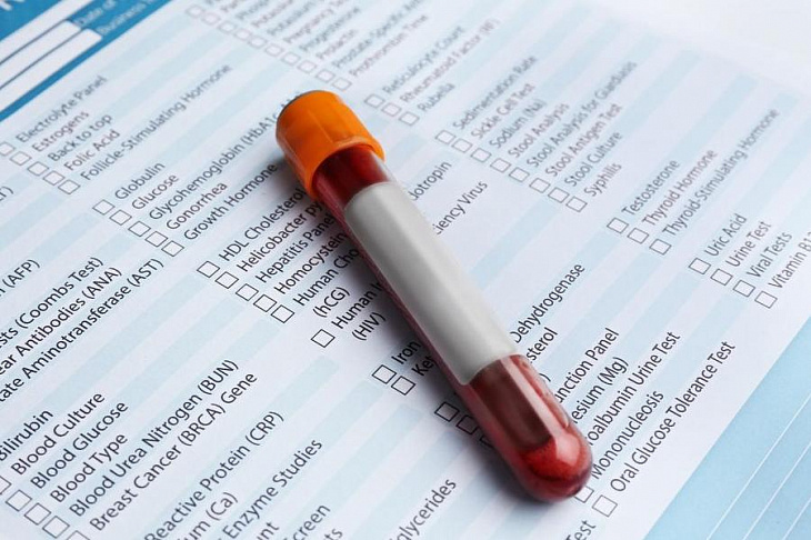 Группа крови оказалась серьезным фактором риска инфицирования коронавирусом