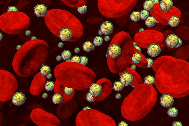 Ученые изучают связь между болезнью Альцгеймера и повышенным уровнем железа