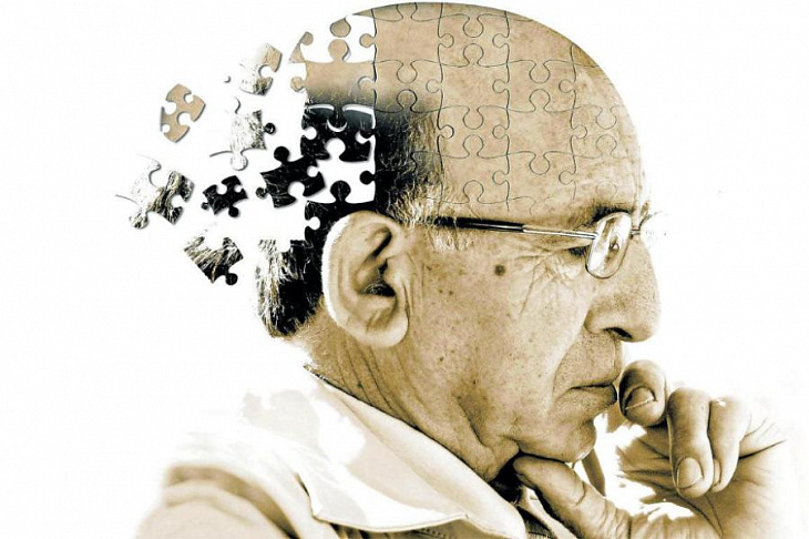 Неврологи приблизились к созданию лекарства против болезни Альцгеймера