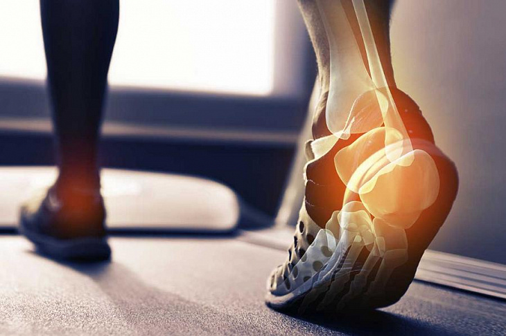 Генетики изменят представления о лечении остеоартрита