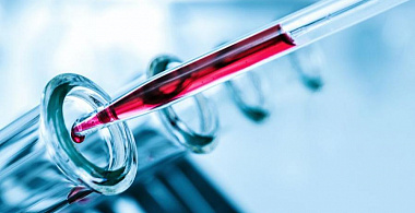 Эксперты разработали новую систему точной оценки здоровья человека